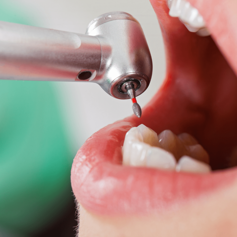 Cesmed-medica-endodonzia-odontoiatria