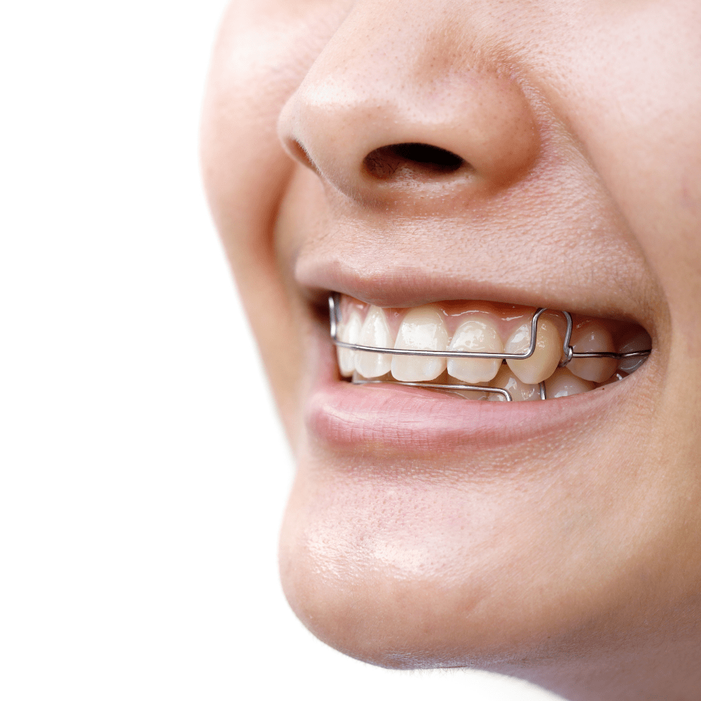 Cesmed-medica-odontoiatria-ortodonzia-intercettiva