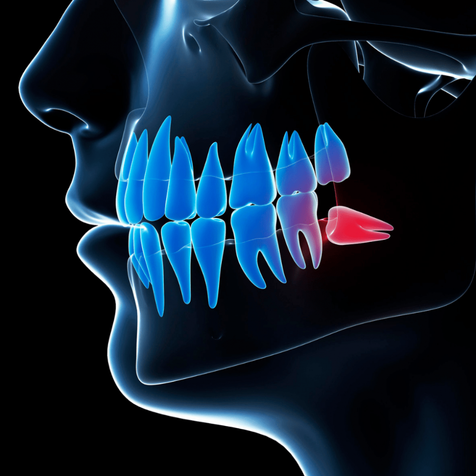 Pulizia Denti Tartaro KIT DI MICROCHIRURGIA Orale Dentale Elevatori Parodontali Strumenti Air-Flow Dental - Foto 8